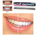 Teeth Whitening hampaidenvalkaisukynä