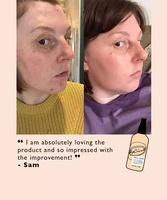 Face Toner with Hyaluronic Acid