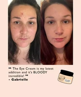 Eye Cream With Hyaluronic acid + coffee