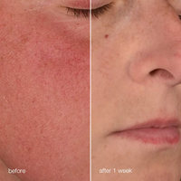 Stabilizing Repair Cream 50 ml