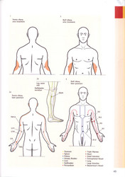 Laser therapy and laser puncture [5008]